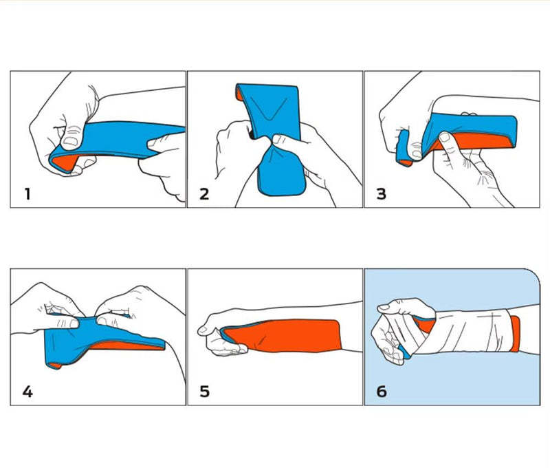 Load image into Gallery viewer, Universal Aluminum Splint Roll Medical Survival Polymer for Fixture Bone Emergency Medical Kit 
